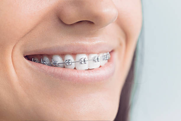Best Traditional Braces  in Scotland Neck, NC